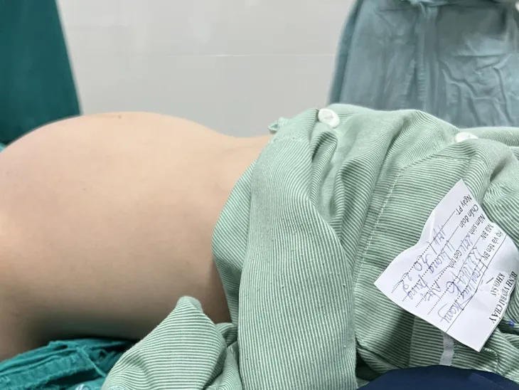 Bảo tồn buồng trứng cho bé gái 12 tuổi có khối u buồng trứng khổng lồ - Ảnh 1. Bảo tồn buồng trứng cho bé gái 12 tuổi có khối u buồng trứng khổng lồ - Ảnh 1.