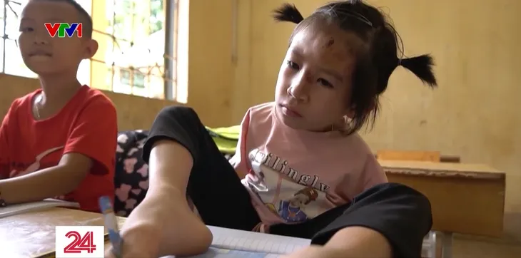 Những “bông hoa trên đá” đầy nghị lực, lạc quan - Ảnh 6. Những “bông hoa trên đá” đầy nghị lực, lạc quan - Ảnh 6.