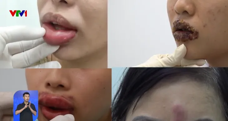 Khó khăn trong quản lý cơ sở thẩm mỹ không phép - Ảnh 1. Khó khăn trong quản lý cơ sở thẩm mỹ không phép - Ảnh 1.