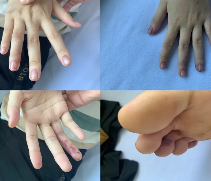 Viêm nội tâm mạc nhiễm khuẩn - Căn bệnh nguy hiểm - Ảnh 1. Viêm nội tâm mạc nhiễm khuẩn - Căn bệnh nguy hiểm - Ảnh 1.