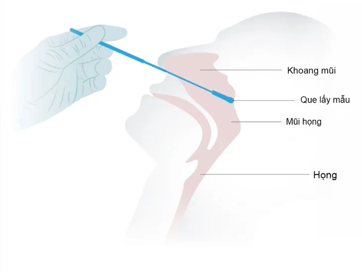 Các bước tự xét nghiệm nhanh COVID-19 tại nhà - Ảnh 1. Các bước tự xét nghiệm nhanh COVID-19 tại nhà - Ảnh 1.