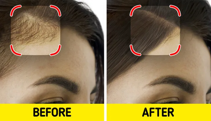 7 bí kíp điều trị hiệu quả tóc gãy rụng, gàu, xơ rối,... - Ảnh 1. 7 bí kíp điều trị hiệu quả tóc gãy rụng, gàu, xơ rối,... - Ảnh 1.