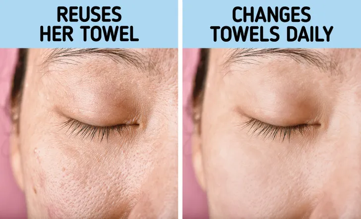 Tại sao không nên sử dụng một chiếc khăn tắm 2 ngày liên tiếp? - Ảnh 3. Tại sao không nên sử dụng một chiếc khăn tắm 2 ngày liên tiếp? - Ảnh 3.