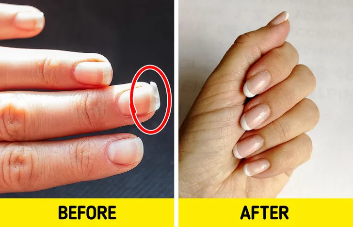 6 mẹo giúp móng tay mọc nhanh và cứng cáp hơn - Ảnh 6. 6 mẹo giúp móng tay mọc nhanh và cứng cáp hơn - Ảnh 6.