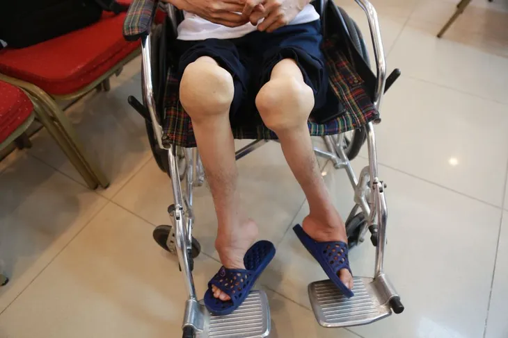 Điều trị dự phòng chảy máu: Tương lai cho người có hemophilia - Ảnh 1. Điều trị dự phòng chảy máu: Tương lai cho người có hemophilia - Ảnh 1.