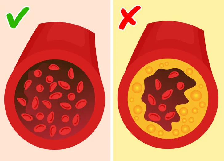 Uống cà phê decaf có thể gây hại đến sức khỏe như thế nào? - Ảnh 2. Uống cà phê decaf có thể gây hại đến sức khỏe như thế nào? - Ảnh 2.