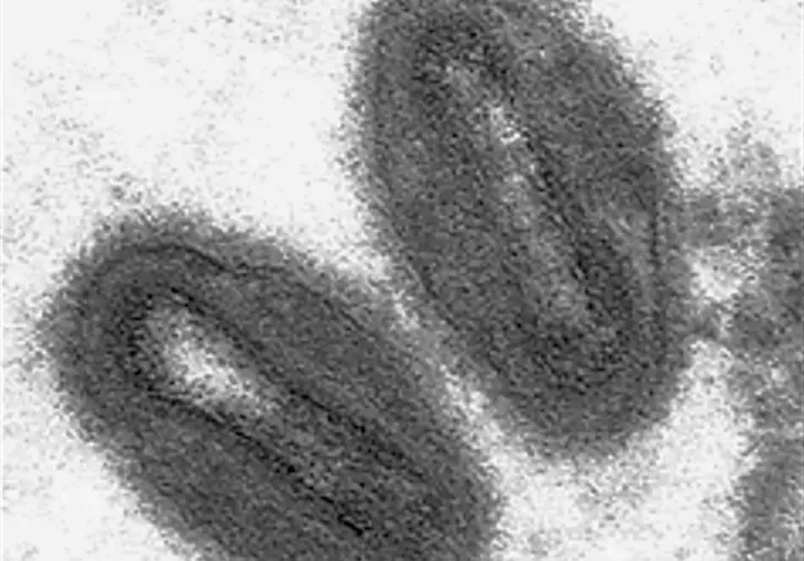 WHO cho biết chưa cấp thiết phải tiêm vaccine bệnh đậu mùa khỉ hàng loạt - Ảnh 1. WHO cho biết chưa cấp thiết phải tiêm vaccine bệnh đậu mùa khỉ hàng loạt - Ảnh 1.