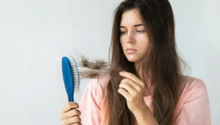 4 cách hiệu quả để chống rụng tóc do buồng trứng đa nang - Ảnh 2. 4 cách hiệu quả để chống rụng tóc do buồng trứng đa nang - Ảnh 2.