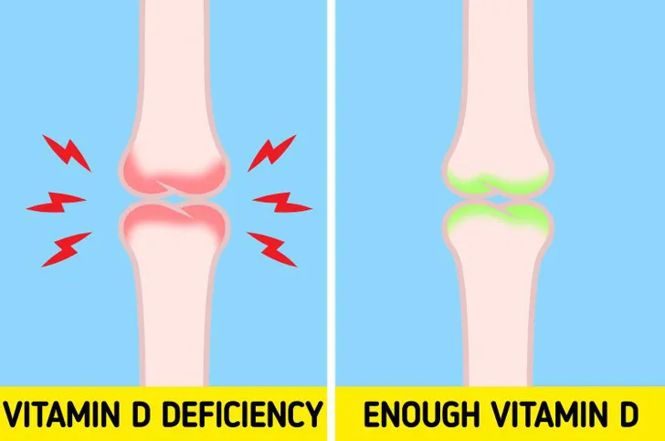6 dấu hiệu cảnh báo cơ thể bạn đang thiếu Vitamin D trầm trọng - Ảnh 4. 6 dấu hiệu cảnh báo cơ thể bạn đang thiếu Vitamin D trầm trọng - Ảnh 4.