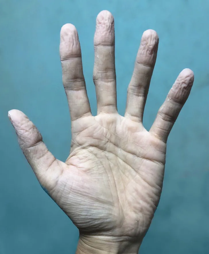 Những dấu hiệu bất thường của cơ thể mà bạn không nên bỏ qua - Ảnh 1. Những dấu hiệu bất thường của cơ thể mà bạn không nên bỏ qua - Ảnh 1.