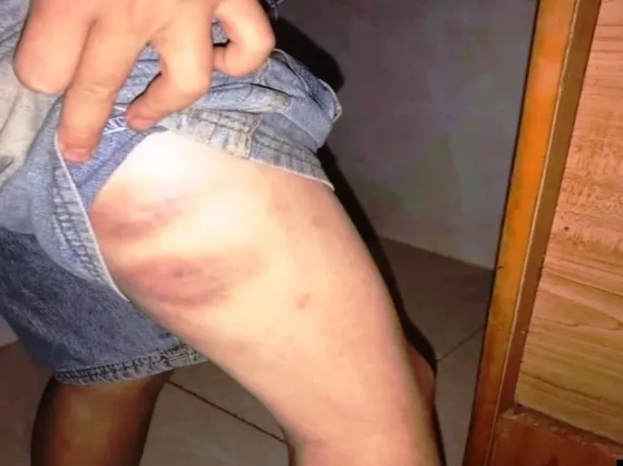 Vụ cháu bé 9 tuổi bị đánh đập ở Đắk Lắk: Khởi tố bà nội và cha ruột - Ảnh 5.