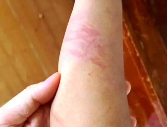 Vụ cháu bé 9 tuổi bị đánh đập ở Đắk Lắk: Khởi tố bà nội và cha ruột - Ảnh 3.