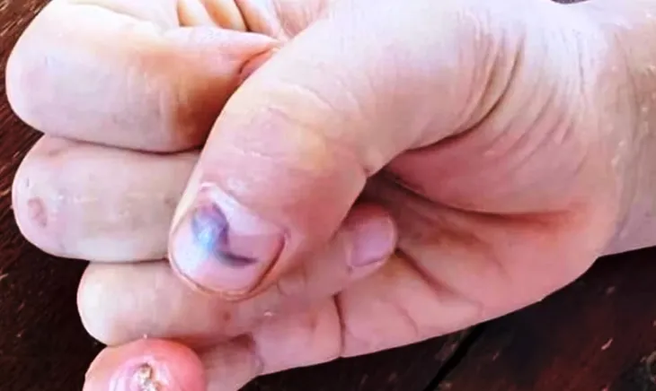 Vụ cháu bé 9 tuổi bị đánh đập ở Đắk Lắk: Khởi tố bà nội và cha ruột - Ảnh 2.