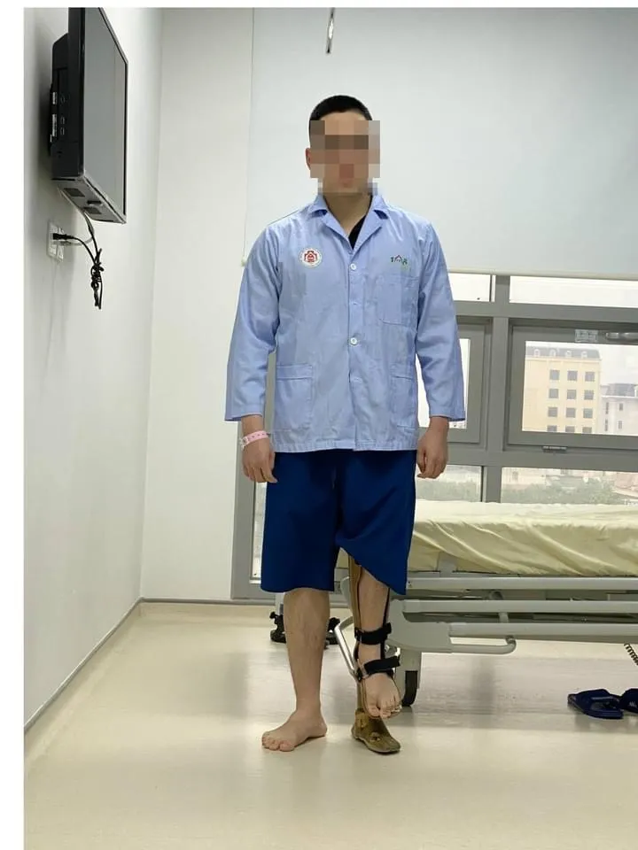 Kỳ tích mới: Kéo dài chân tới... 18 cm cho chàng trai mắc dị tật chân cao chân thấp - Ảnh 1. Kỳ tích mới: Kéo dài chân tới... 18 cm cho chàng trai mắc dị tật chân cao chân thấp - Ảnh 1.