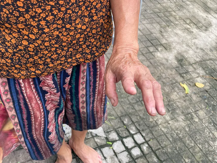 Tử thần rình rập ở làng nuôi rắn độc - Ảnh 4.