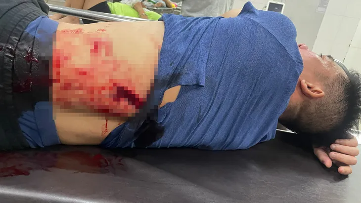 Xin đá uống bia không được, nhóm côn đồ vác mã tấu truy sát người trong đêm - Ảnh 1. Xin đá uống bia không được, nhóm côn đồ vác mã tấu truy sát người trong đêm - Ảnh 1.