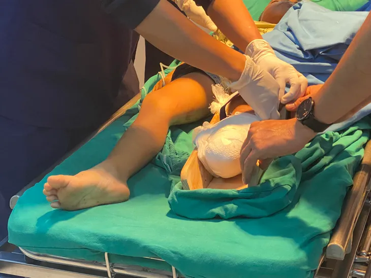 Bé trai 6 tuổi đứt lìa chân do dây neo tàu cuốn - Ảnh 2. Bé trai 6 tuổi đứt lìa chân do dây neo tàu cuốn - Ảnh 2.