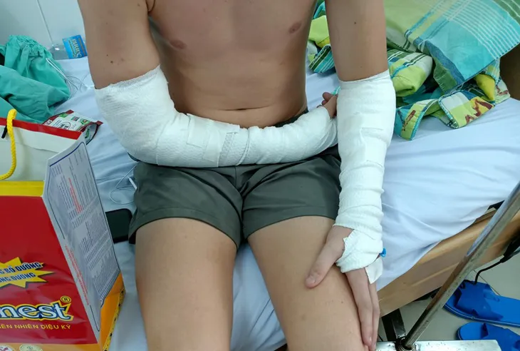 Liên tiếp các vụ chó thả rông cắn người nhập viện trên đường phố - Ảnh 1. Liên tiếp các vụ chó thả rông cắn người nhập viện trên đường phố - Ảnh 1.