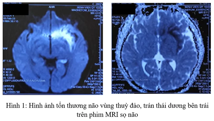 Nam thanh niên nguy kịch do viêm não - Ảnh 1. Nam thanh niên nguy kịch do viêm não - Ảnh 1.