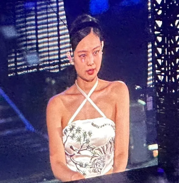 Jennie (BLACKPINK) bị thương ở mắt, vẫn tiếp tục lưu diễn - Ảnh 2. Jennie (BLACKPINK) bị thương ở mắt, vẫn tiếp tục lưu diễn - Ảnh 2.