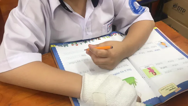 Kỷ luật cảnh cáo cô giáo đánh gãy xương ngón tay học sinh - Ảnh 1. Kỷ luật cảnh cáo cô giáo đánh gãy xương ngón tay học sinh - Ảnh 1.
