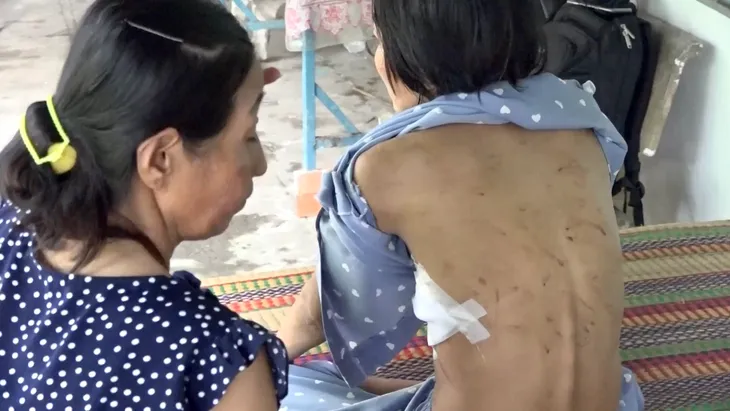 Người phụ nữ bị chồng hờ ở An Giang bạo hành dã man - Ảnh 3.