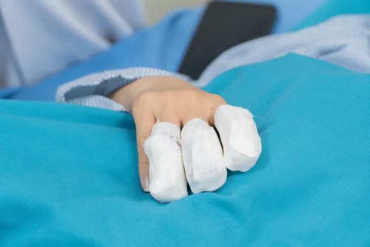 Đứt rời, chấn thương ngón tay do máy thái chuối - Ảnh 1. Đứt rời, chấn thương ngón tay do máy thái chuối - Ảnh 1.