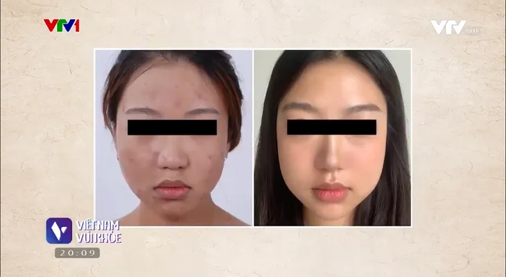 Dùng mỹ phẩm quá sớm và hệ lụy với sức khỏe làn da - Ảnh 2.