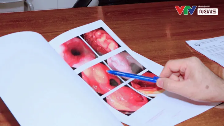 Tầm soát ung thư ống tiêu hóa: Đừng để quá muộn - Ảnh 4. Tầm soát ung thư ống tiêu hóa: Đừng để quá muộn - Ảnh 4.