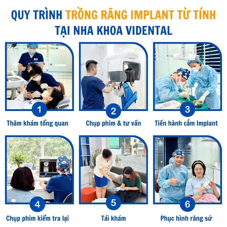 Nha khoa ViDental trồng răng bằng công nghệ từ tính, không khoan xương - Ảnh 4. Nha khoa ViDental trồng răng bằng công nghệ từ tính, không khoan xương - Ảnh 4.