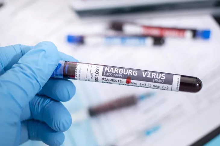 Cảnh báo nguy cơ virus Marburg lây lan từ châu Phi - Ảnh 1.