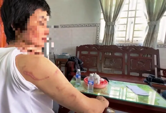 Mang thai tháng thứ 7 vẫn bị chồng bạo hành không thương tiếc - Ảnh 1. Mang thai tháng thứ 7 vẫn bị chồng bạo hành không thương tiếc - Ảnh 1.