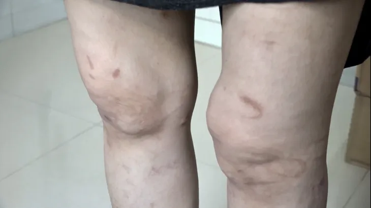 Người phụ nữ mang thai bị chồng bạo hành sẽ quay lại Hải Dương để làm rõ vụ việc - Ảnh 4. Người phụ nữ mang thai bị chồng bạo hành sẽ quay lại Hải Dương để làm rõ vụ việc - Ảnh 4.