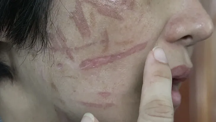 Người phụ nữ mang thai bị chồng bạo hành sẽ quay lại Hải Dương để làm rõ vụ việc - Ảnh 3. Người phụ nữ mang thai bị chồng bạo hành sẽ quay lại Hải Dương để làm rõ vụ việc - Ảnh 3.