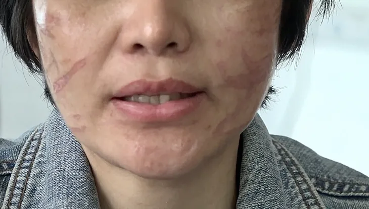 Người phụ nữ mang thai bị chồng bạo hành sẽ quay lại Hải Dương để làm rõ vụ việc - Ảnh 5. Người phụ nữ mang thai bị chồng bạo hành sẽ quay lại Hải Dương để làm rõ vụ việc - Ảnh 5.
