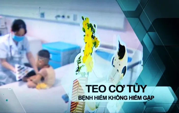 Teo cơ tủy - Bệnh hiếm nhưng không hiếm gặp - Ảnh 2. Teo cơ tủy - Bệnh hiếm nhưng không hiếm gặp - Ảnh 2.