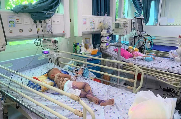 Số ca tay chân miệng tăng cao: Cần tính toán dự trữ thuốc lâu dài - Ảnh 1. Số ca tay chân miệng tăng cao: Cần tính toán dự trữ thuốc lâu dài - Ảnh 1.