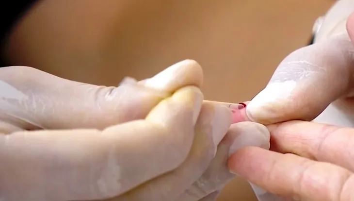 Cần có những quy định mới để trẻ dưới 15 tuổi được xét nghiệm sớm HIV - Ảnh 3. Cần có những quy định mới để trẻ dưới 15 tuổi được xét nghiệm sớm HIV - Ảnh 3.