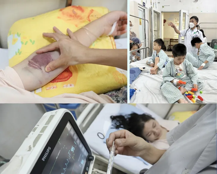 Sốt xuất huyết diễn biến phức tạp - Vì sao khó dập dịch? - Ảnh 3. Sốt xuất huyết diễn biến phức tạp - Vì sao khó dập dịch? - Ảnh 3.