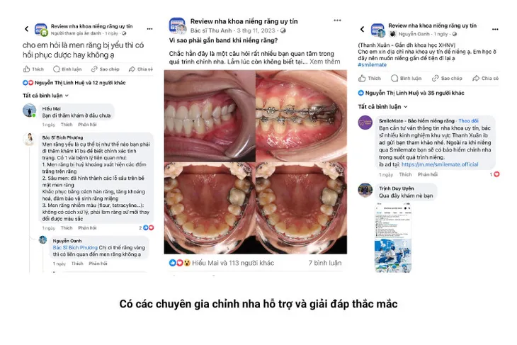 Từ nỗi đau cá nhân đến sứ mệnh xã hội: Câu chuyện của cô gái niềng răng hỏng - Ảnh 1. Từ nỗi đau cá nhân đến sứ mệnh xã hội: Câu chuyện của cô gái niềng răng hỏng - Ảnh 1.