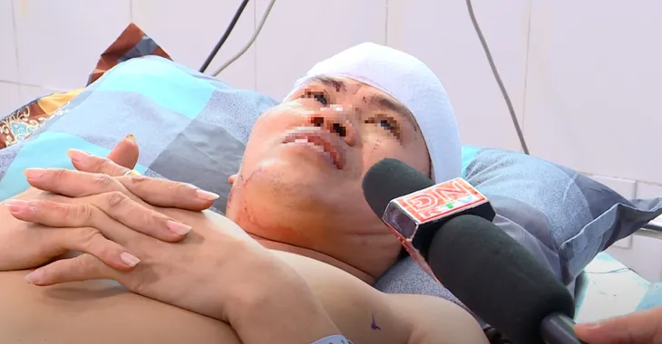 Bước đầu xác định nguyên nhân vụ nổ lò hơi làm 6 người thiệt mạng ở Đồng Nai - Ảnh 3. Bước đầu xác định nguyên nhân vụ nổ lò hơi làm 6 người thiệt mạng ở Đồng Nai - Ảnh 3.
