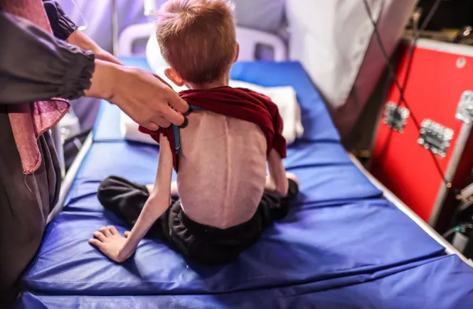 Liên hợp quốc: Nạn đói đã lan rộng khắp Dải Gaza - Ảnh 1.