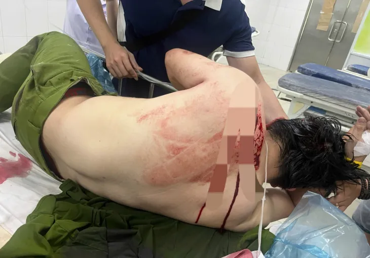 Bắt giữ đối tượng vào nhà thờ gây rối rồi dùng dao đâm 2 cán bộ công an - Ảnh 1. Bắt giữ đối tượng vào nhà thờ gây rối rồi dùng dao đâm 2 cán bộ công an - Ảnh 1.