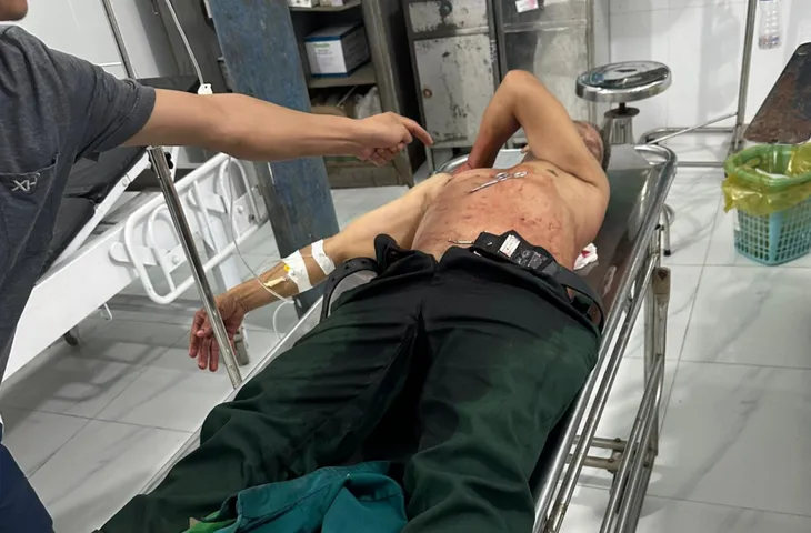 Tài xế xe ôm may mắn thoát chết sau khi bị đâm nhiều nhát vào người - Ảnh 1. Tài xế xe ôm may mắn thoát chết sau khi bị đâm nhiều nhát vào người - Ảnh 1.
