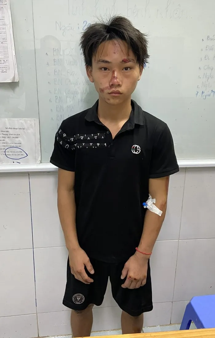 Trưởng Công an xã ở Lào Cai bị thiếu niên 16 tuổi tông trọng thương - Ảnh 1. Trưởng Công an xã ở Lào Cai bị thiếu niên 16 tuổi tông trọng thương - Ảnh 1.