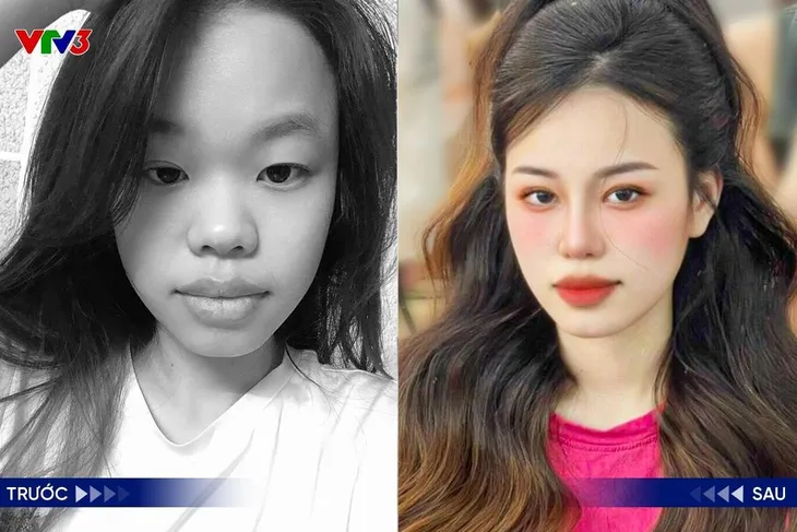 Khám phá các phương pháp làm đẹp an toàn và hiệu quả - Ảnh 4. Khám phá các phương pháp làm đẹp an toàn và hiệu quả - Ảnh 4.