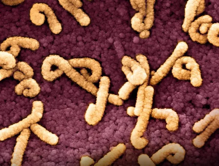 Nga phát triển vaccine ngừa virus Marburg gây chết người - Ảnh 1.