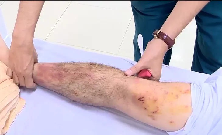 Hai phi công thoát hiểm vụ tai nạn máy bay kể về giây phút khẩn nguy trên không - Ảnh 2. Hai phi công thoát hiểm vụ tai nạn máy bay kể về giây phút khẩn nguy trên không - Ảnh 2.