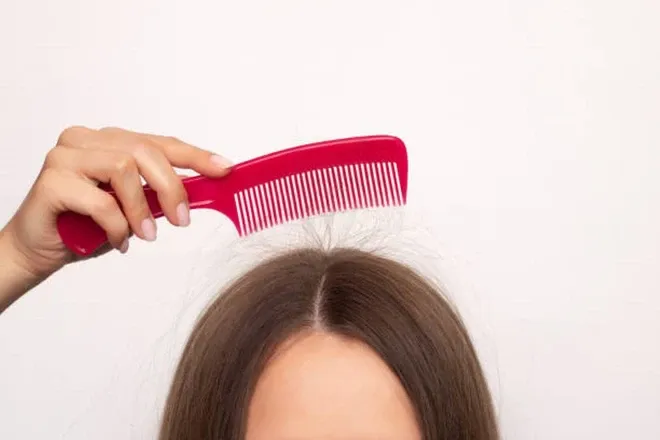 Loại bỏ tĩnh điện trên mái tóc vào mùa Đông chỉ với 7 mẹo nhỏ - Ảnh 2. Loại bỏ tĩnh điện trên mái tóc vào mùa Đông chỉ với 7 mẹo nhỏ - Ảnh 2.