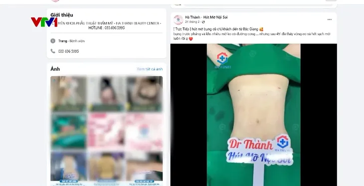 Hà Nội: Phát hiện cơ sở thẩm mỹ trái phép hút mỡ cho hàng trăm người  - Ảnh 4.